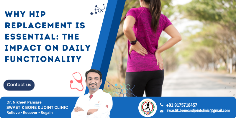 best hip replacement surgeon in Pune