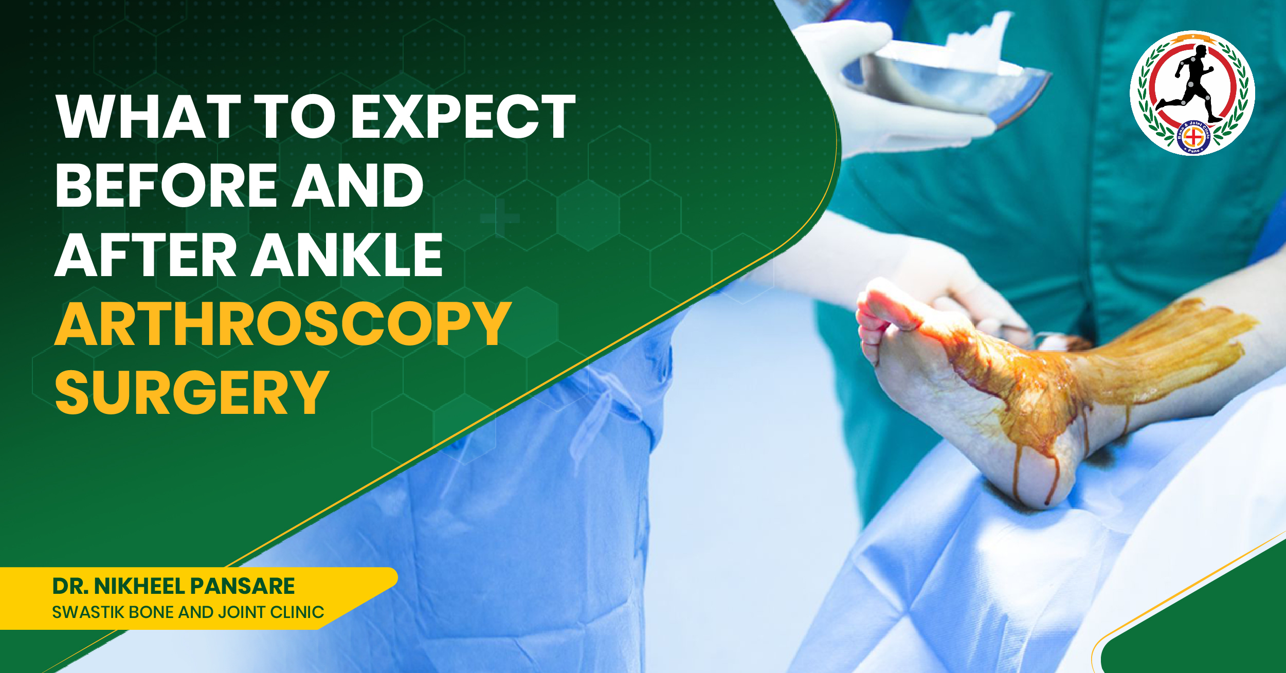 Best Ankle Arthroscopic Surgeon in Viman Nagar, Near Kharadi