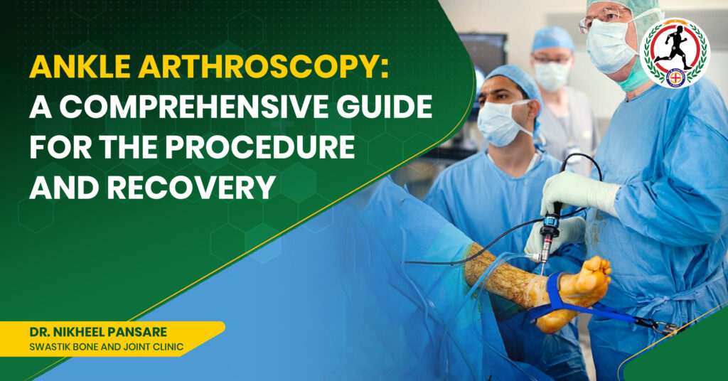 Ankle Arthroscopy