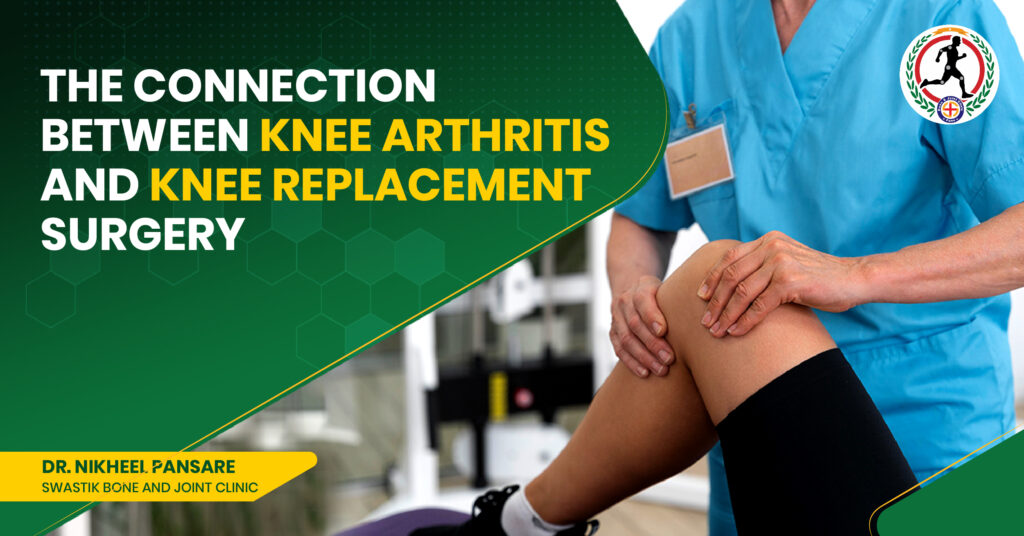knee replacement surgeon