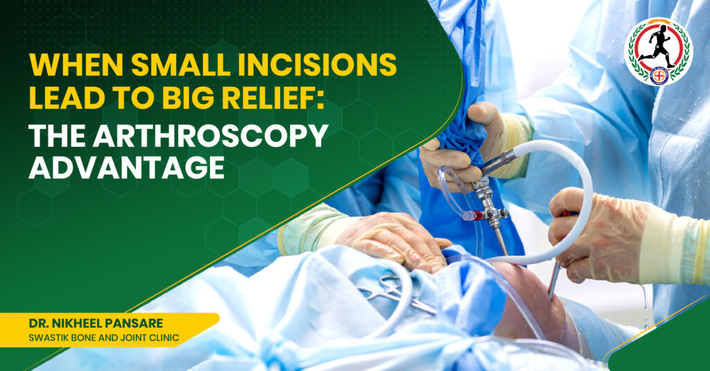 arthroscopy surgeon in Kharadi