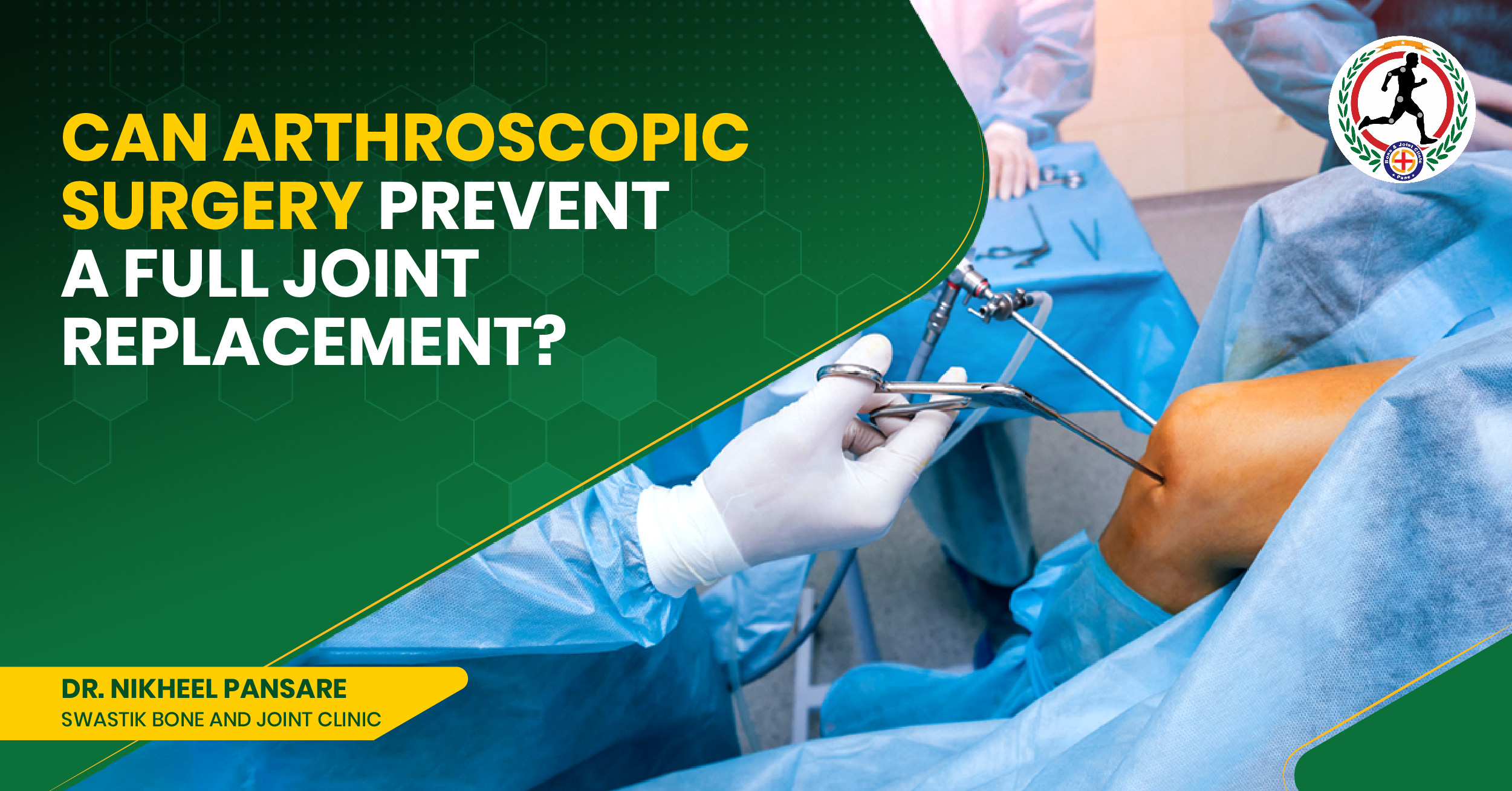 best arthroscopy surgeon in Kharadi