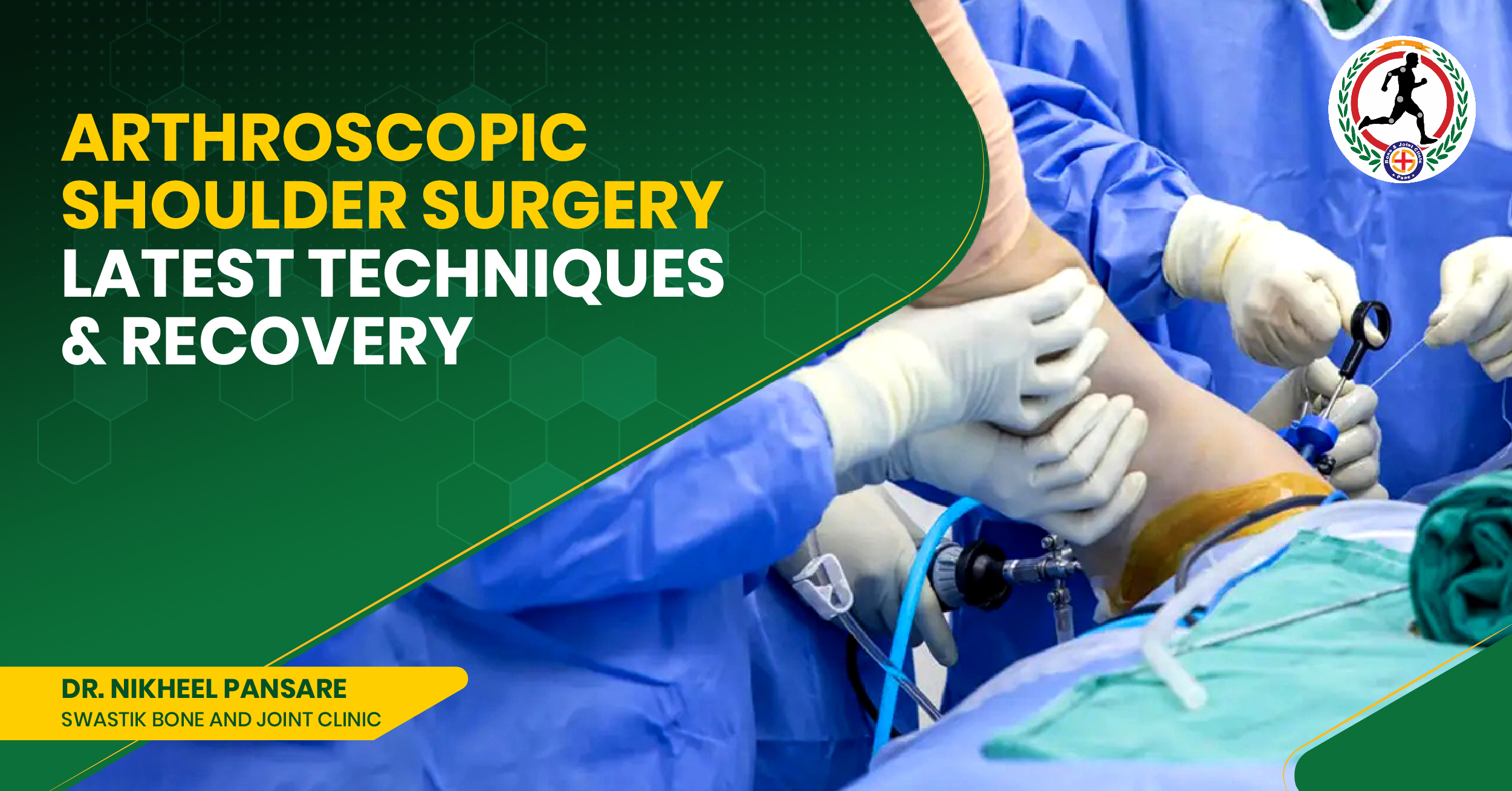Arthroscopic Shoulder Surgery in Kharadi